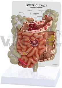 GI Tract